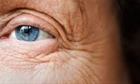 Wrinkles issue a remedy for aged people